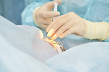 Oftalmoloji lazer mikroskop operasyonu. Klinikte doktor. Hasta göz tedavisi. Miyopi ve katarakt giderme