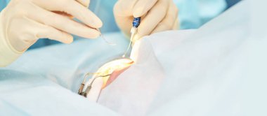 Oftalmoloji lazer mikroskop operasyonu. Klinikte doktor. Hasta göz tedavisi. Miyopi ve katarakt giderme