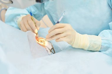 Oftalmoloji lazer mikroskop operasyonu. Klinikte doktor. Hasta göz tedavisi. Miyopi ve katarakt giderme