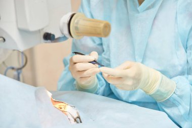 Oftalmoloji lazer mikroskop operasyonu. Klinikte doktor. Hasta göz tedavisi. Miyopi ve katarakt giderme
