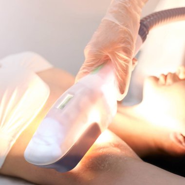 Lazer elos tıbbi cihaz. İstenmeyen kıl ve asterikleri kaldırın. Kuaförde kozmetoloji spa prosedürü. Amprit epilasyonu