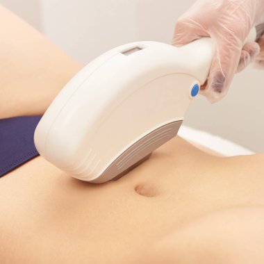 Lazer elos tıbbi cihaz. İstenmeyen kıl ve asterikleri kaldırın. Kuaförde kozmetoloji spa prosedürü