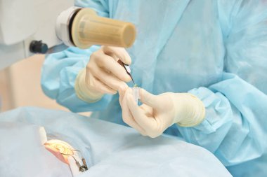 Oftalmoloji lazer mikroskop operasyonu. Klinikte doktor. Hasta göz tedavisi. Miyopi ve katarakt giderme