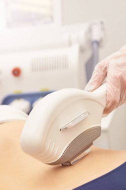 Lazer elos tıbbi cihaz. İstenmeyen kıl ve asterikleri kaldırın. Kuaförde kozmetoloji spa prosedürü. Depilasyon ekipmanı