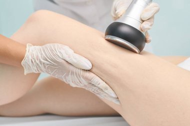 Cavitation RF vücut tedavisi. Kadın ultra ses lipo makinesi. Spa hatları. Doktor elleri