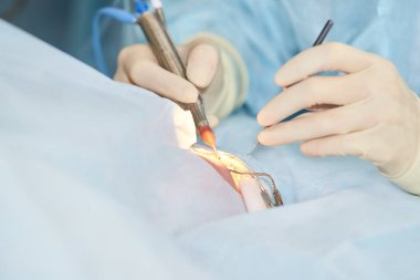 Oftalmoloji lazer mikroskop operasyonu. Klinikte doktor. Hasta göz tedavisi. Miyopi ve katarakt giderme