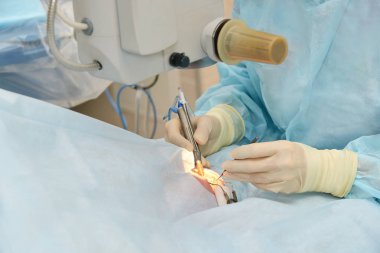 Oftalmoloji lazer mikroskop operasyonu. Klinikte doktor. Hasta göz tedavisi. Miyopi ve katarakt giderme
