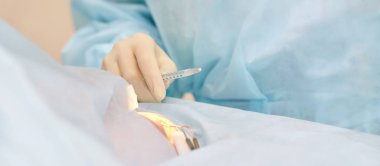 Oftalmoloji lazer mikroskop operasyonu. Klinikte doktor. Hasta göz tedavisi. Miyopi ve katarakt giderme