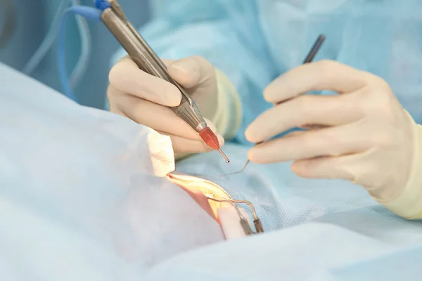 Operação de microscópio a laser oftalmológico. Doutor na clínica. Tratamento ocular do paciente. Miopia e remoção de catarata — Fotografia de Stock