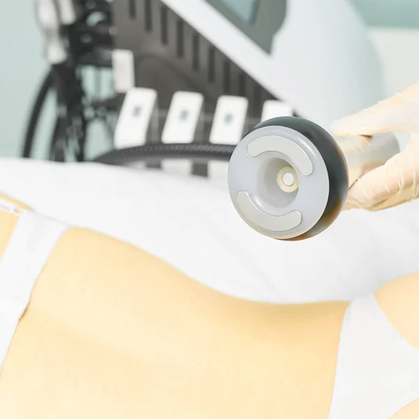 Dispositivo de masaje al vacío. Tratamiento anticelulítico de corrección corporal. Aparato de pérdida de peso. Mujer y médico en el salón de medicina — Foto de Stock