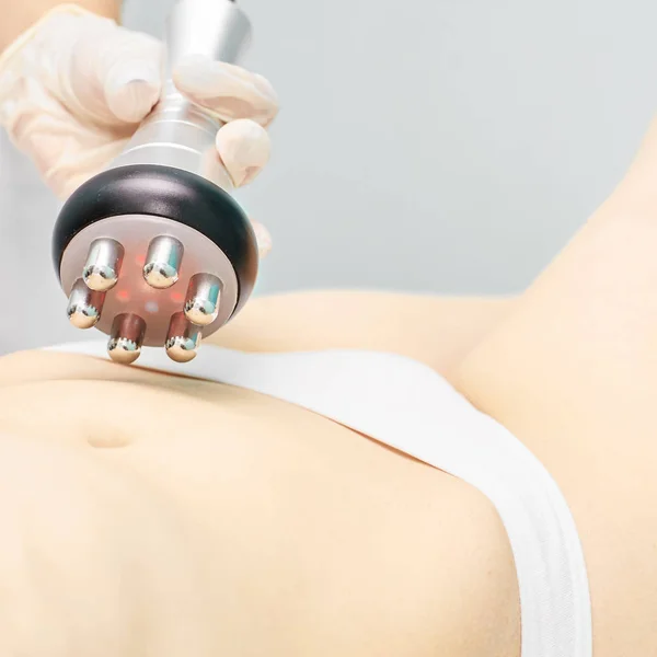 Mükemmel vücut telsizi tedavisi. Spa 'daki kadın. Doktor eli ve kız vücudu. RF kozmetik kaldırma. Göbek derisi