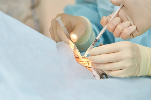 Operación de microscopio láser oftalmológico. Doctor en clínica. Tratamiento ocular del paciente. Miopía y eliminación de cataratas — Foto de Stock