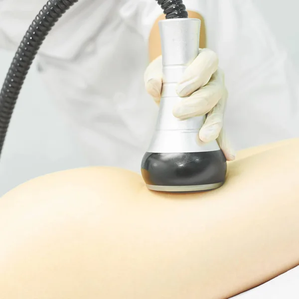 Dispositivo de masaje al vacío. Tratamiento anticelulítico de corrección corporal. Aparato de pérdida de peso. Mujer y médico en el salón de medicina — Foto de Stock