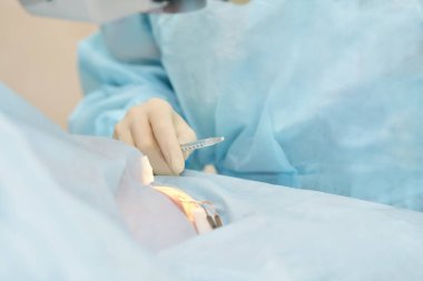 Oftalmoloji lazer mikroskop operasyonu. Klinikte doktor. Hasta göz tedavisi. Miyopi ve katarakt giderme