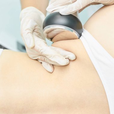 Cavitation RF vücut tedavisi. Kadın ultra ses lipo makinesi. Spa hatları. Doktor elleri