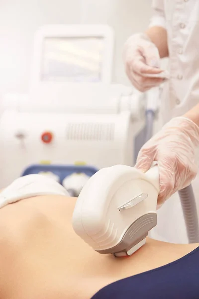 Dispositivo médico láser elos. Quitar el pelo no deseado y asteriks. Procedimiento de spa de cosmetología en el salón. Depilación láser Decollete — Foto de Stock