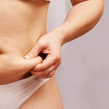 Şişman, sağlıksız kadın vücudu. Göbek tarafı sıkıştı. Ölçülü kadın prosedürü. İlaç çimdikliyor. Selülit önleyici aşırı ağırlık