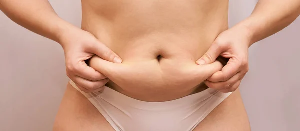 Cuerpo de mujer gorda y malsana. Pellizca el lado del vientre. Procedimiento de medición de dama. Un pinchazo de medicina. Anti celulitis sobrepeso — Foto de Stock