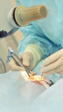 Oftalmoloji lazer mikroskop operasyonu. Klinikte doktor. Hasta göz tedavisi. Miyopi ve katarakt giderme
