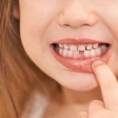 Young girl point on milk tooth. Baby losing teeth
