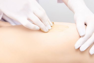 Spa lüks stüdyosunda saç kesimi. Kadın bacakları titreyerek ağda yapıyor. Sıcak şeker