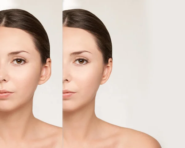 Güzel genç kız. Portreden önce ve sonra. Estetik terapi. Büyük kulak sonucu — Stok fotoğraf