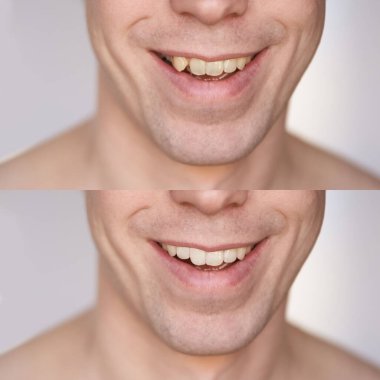 Konseptten önce. Erkek gülümsemesi. Yaklaş.