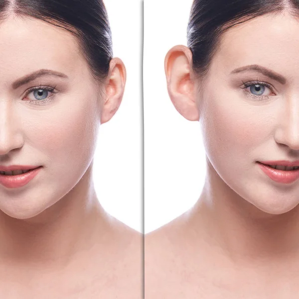 Chica antes y después de la cirugía plástica cosmetología —  Fotos de Stock