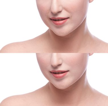 Estetik ameliyattan önce ve sonra kız