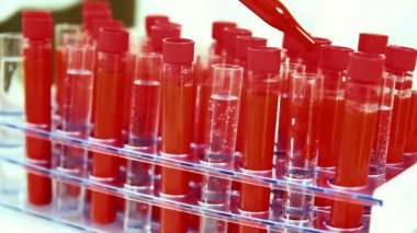Pipet ile kırmızı sıvı Test tüplerde dökme. Laboratuvar araştırmacı test tüpleri ile kimyasal sıvı dolum.