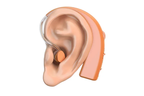 Audífono en el oído, representación 3D —  Fotos de Stock