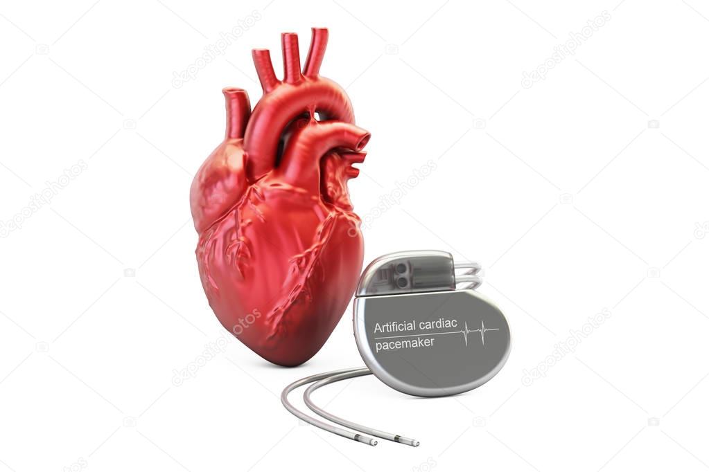 Artificial cardiac pacemaker, 3D rendering
