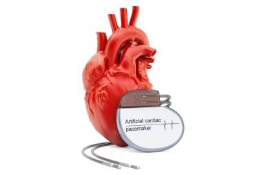Artificial cardiac pacemaker with human heart, 3D rendering clipart