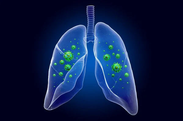 Легені з вірусом, ефект примарного світла, рентгенівська голограма — стокове фото