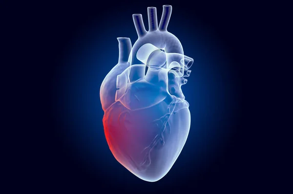 Біль у концепції серця. Ефект примарного світла, рентгенівська голограма — стокове фото