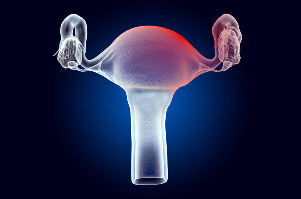 Pain in Uterus concept. Ghost light effect, x-ray hologram