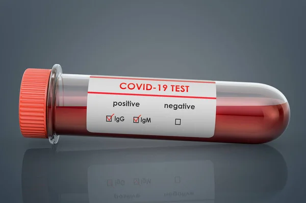 Prueba Del Coronavirus Covid Tubo Ensayo Con Muestras Sangre Positivas —  Fotos de Stock