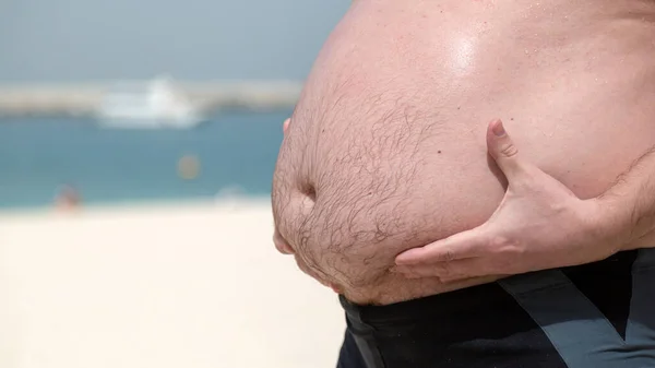 Barriga Grande Masculina Problema Obesidade Homem Segura Sua Barriga Gorda — Fotografia de Stock