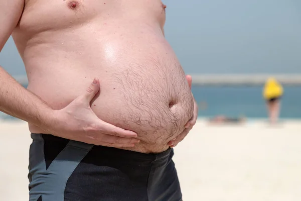 Barriga Grande Masculina Problema Obesidade Homem Segura Sua Barriga Gorda — Fotografia de Stock