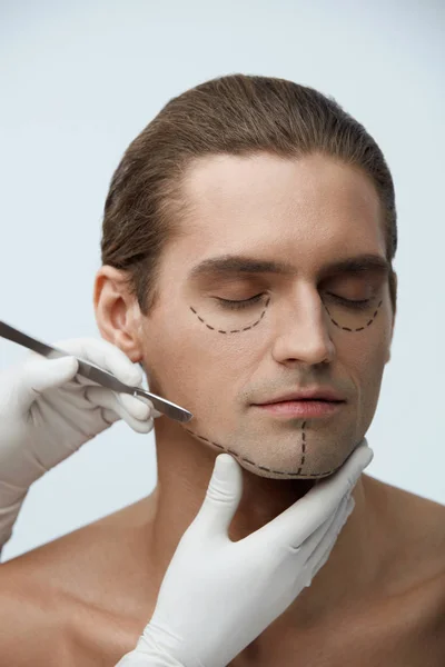 Chirurgia plastyczna. Zbliżenie twarzy przystojny mężczyzna z czarnymi liniami — Zdjęcie stockowe