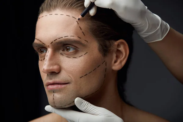 Homem bonito com linhas no rosto antes da cirurgia plástica — Fotografia de Stock