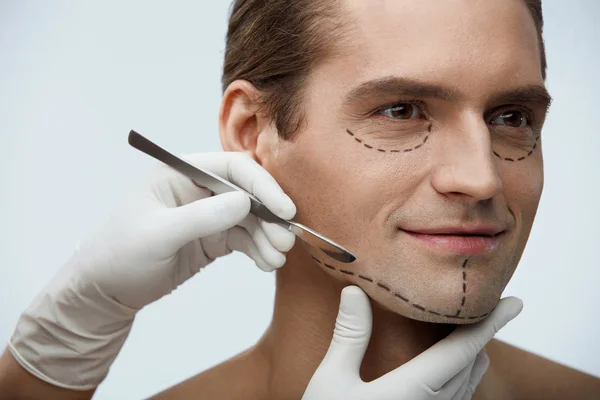 Knappe Man met lijnen op gezicht voor plastische chirurgie — Stockfoto