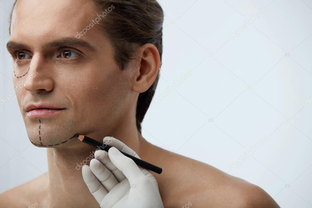 Facial Beauty Operation. Handsome Man With Lines On Face 