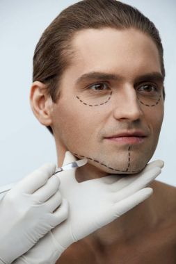 Estetik ameliyattan önce yüzündeki çizgilerle yakışıklı adam