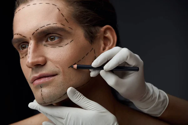 Pohledný muž s linkami na tvář před plastické chirurgie — Stock fotografie