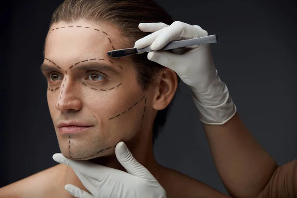 Férfi fekete vonalak a arc-plasztikai sebészet-művelet előtt — Stock Fotó