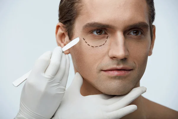 Chirurgie plastique. Portrait de bel homme avec des lignes sur le visage — Photo