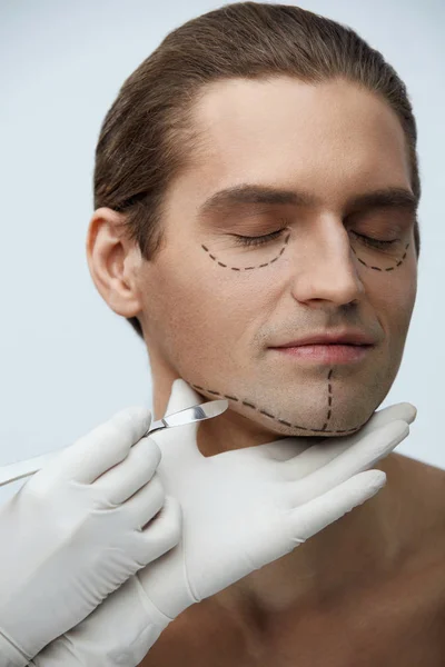 Plastická chirurgie. Mužská tvář s černými čarami na kůži obličeje — Stock fotografie