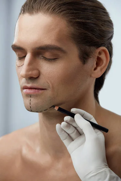 Cirugía plástica. Cara masculina con líneas negras en la piel facial — Foto de Stock