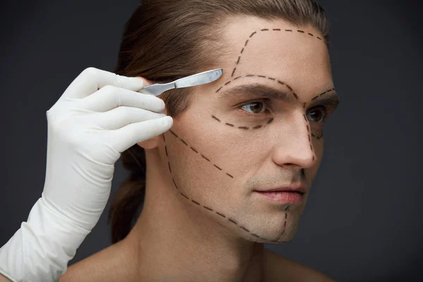 Férfi fekete vonalak a arc-plasztikai sebészet-művelet előtt — Stock Fotó